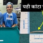 पटना एम्स की बड़ी कामयाबी: 35 मिमी मछली का कांटा निकालकर बचाई मरीज की जिंदगी, लिमका बुक में दर्ज हुआ रिकॉर्ड