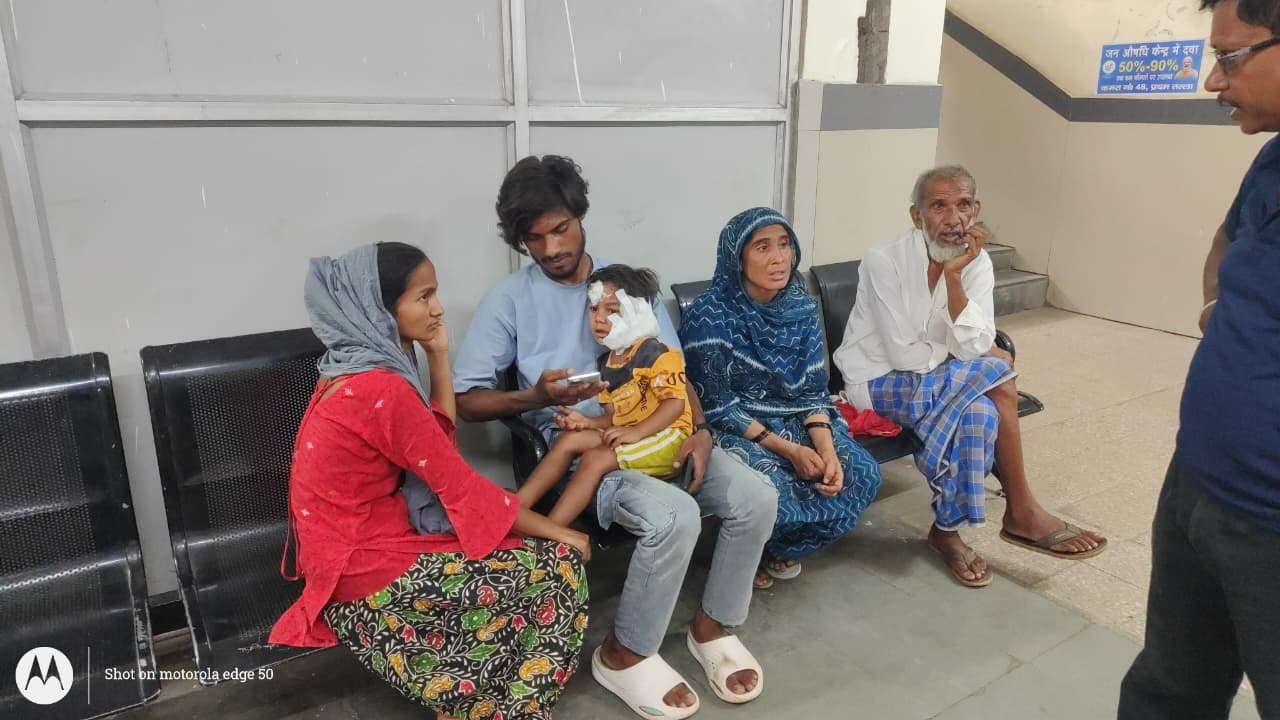 गिरिडीह में आवारा कुत्ते का मासूम पर हमला: चार वर्षीय बच्चे का चेहरा बुरी तरह जख्मी, बेहतर इलाज के लिए रिम्स रेफर
