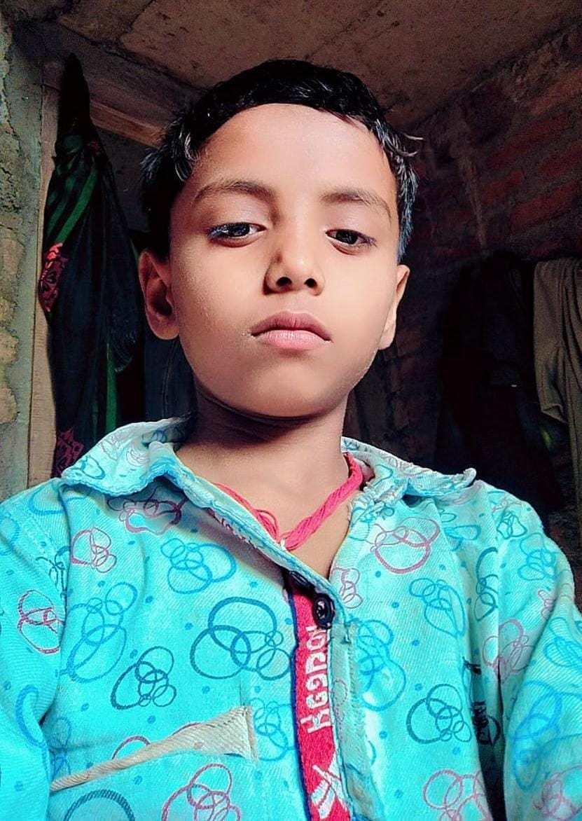बांका में दर्दनाक हादसा: हलवाई की दुकान पर खौलते तेल की कढ़ाई में गिरने से 11 वर्षीय मासूम शुभम की मौत