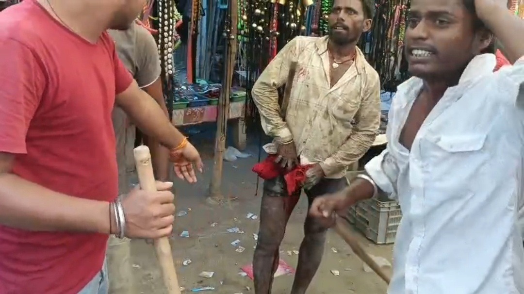 बाबा कारू मंदिर विवाद को लेकर दो पक्षों में गोलीबारी, पिता-पुत्र घायल; इलाके में तनाव